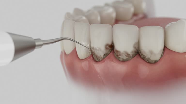 Trusted Wisdom Tooth Removal service in Westby, WI - Dentist Open Now